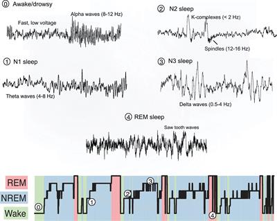 Frontiers | New And Emerging Approaches To Better Define Sleep ...